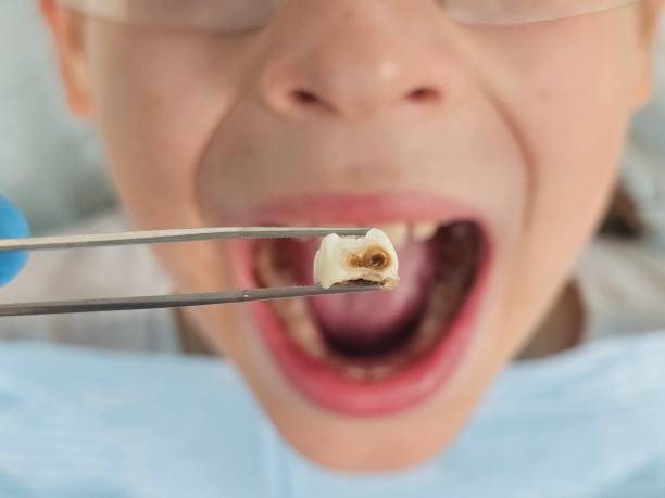 Best Emergency Treatment for Jaw Pain or Injury in Millbrae, CA